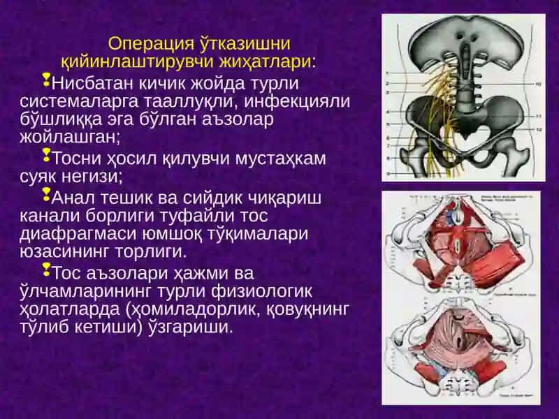 Тос чаноғи топографик анатомияси. Тос бўшлиғи аъзоларида асосий операциялар. 2