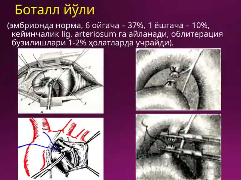 Laparotomiyaturlari 2