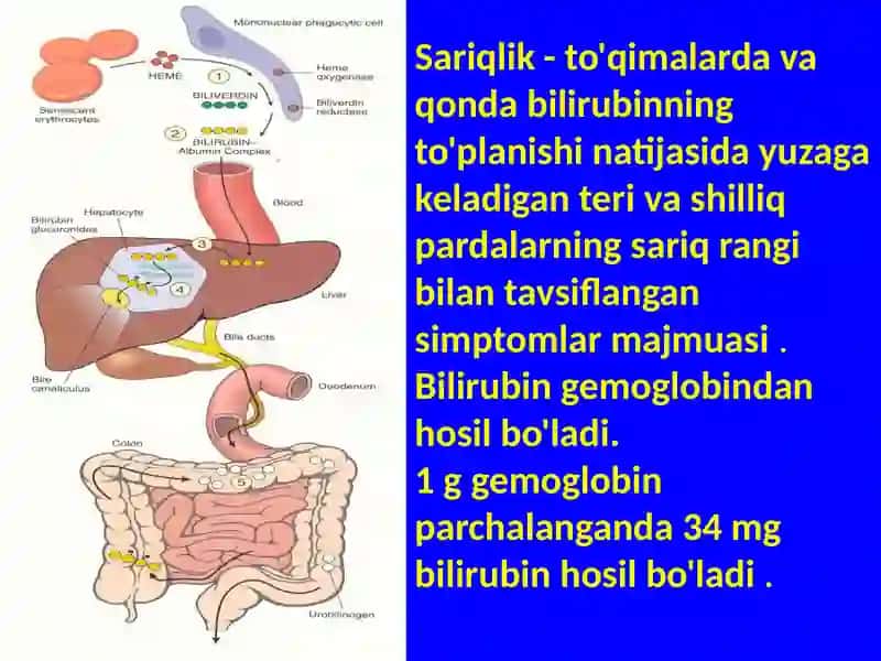 YANGI TUG'ILGAN SARIQLIK PATOGENEZI HAQIDA 2