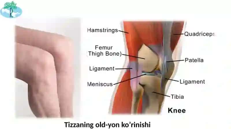 Tizza bo’g’imi shikastlanishlari 2