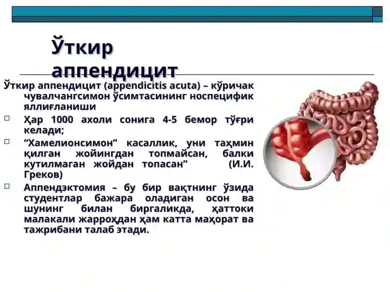 Ўткир аппендицит ва унинг асоратлари 2