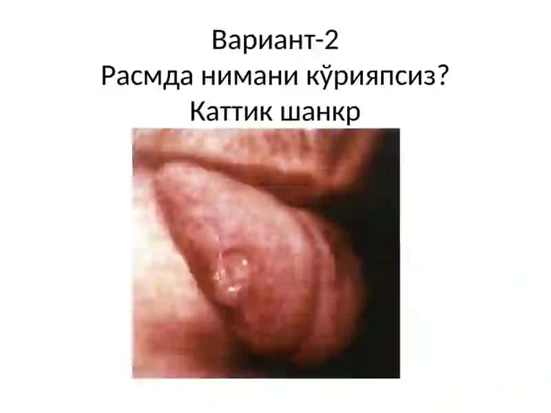 Расмдани маник ўрияпсиз 2