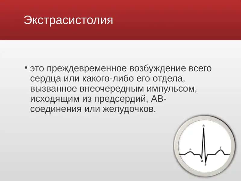 Экстрасистолии 2