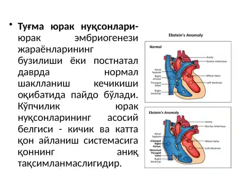 Tug’mayurak nuqsonlari 2