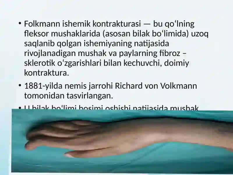 Folkman ishemik kontrakturasi 2