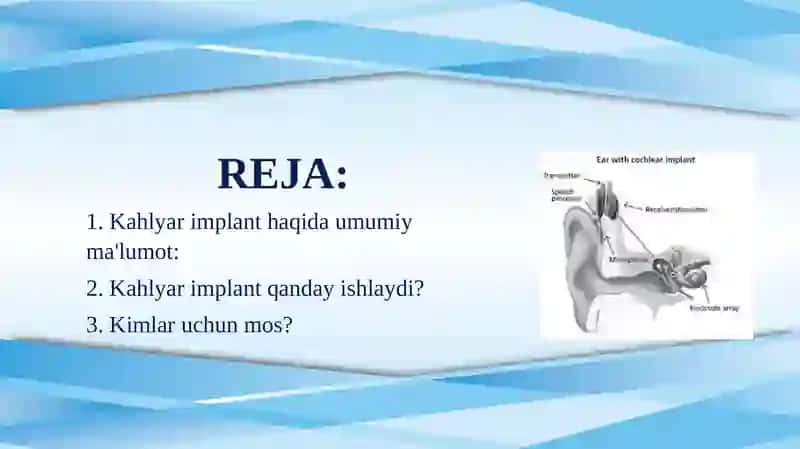 KAHLYAR IMPLANT TAQDIMOTI 2