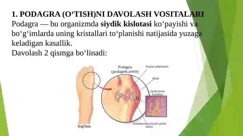 Podagra va semizlikni bartaraf etuvchi vositalar 2