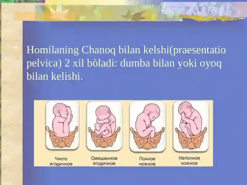 Homilaning chanoq bilan kelishi. 2