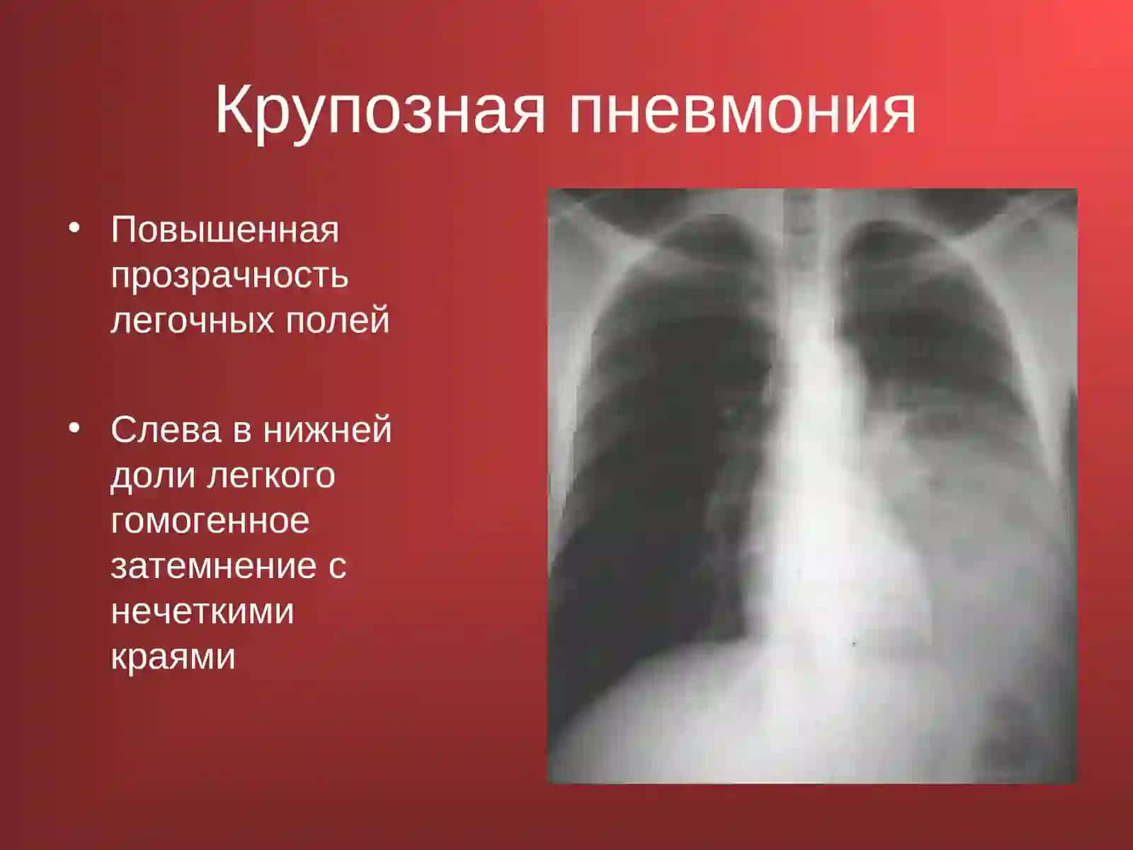 Норма 2
