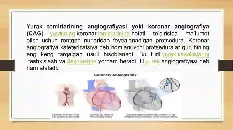 Koronar angiografiya 2