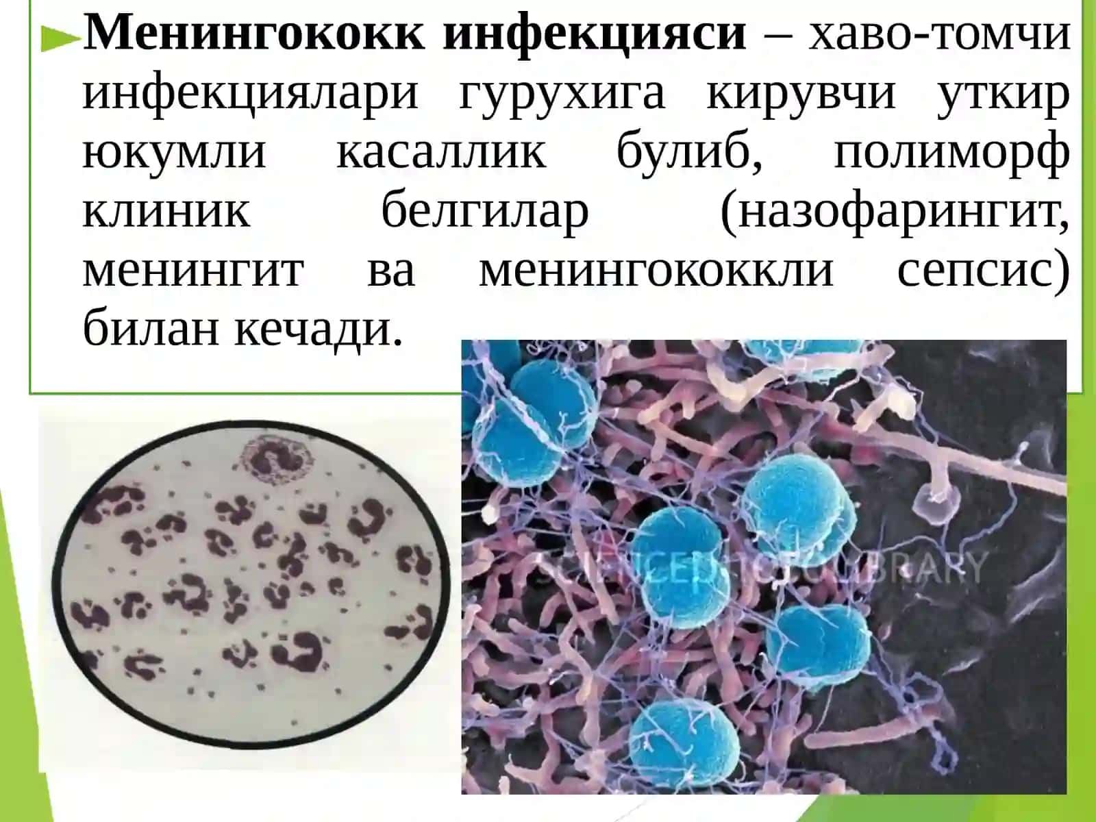Менингококкли инфекция энцефалит ва полиомиелит патоморфологияси 2