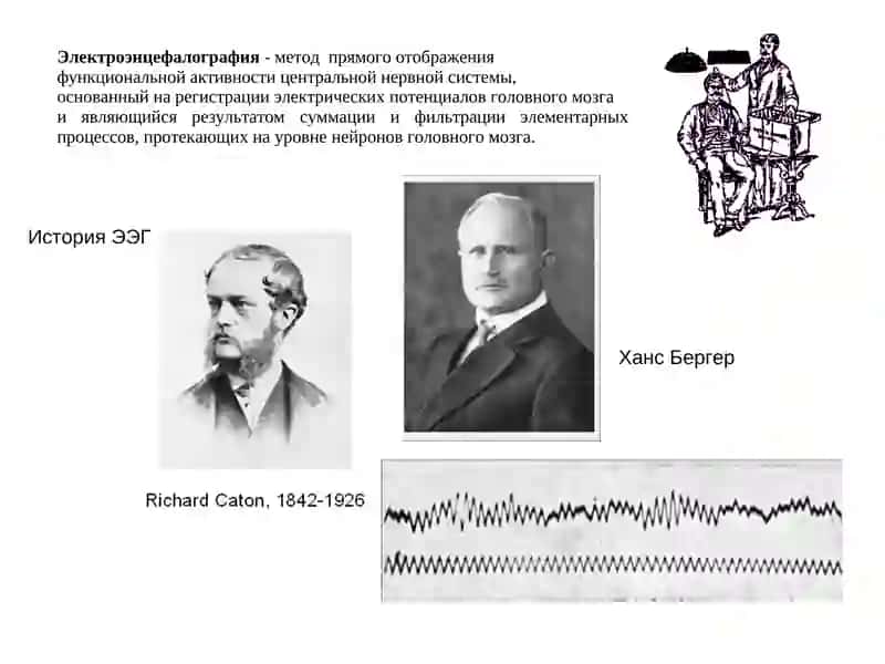 Электроэнцефалография 2