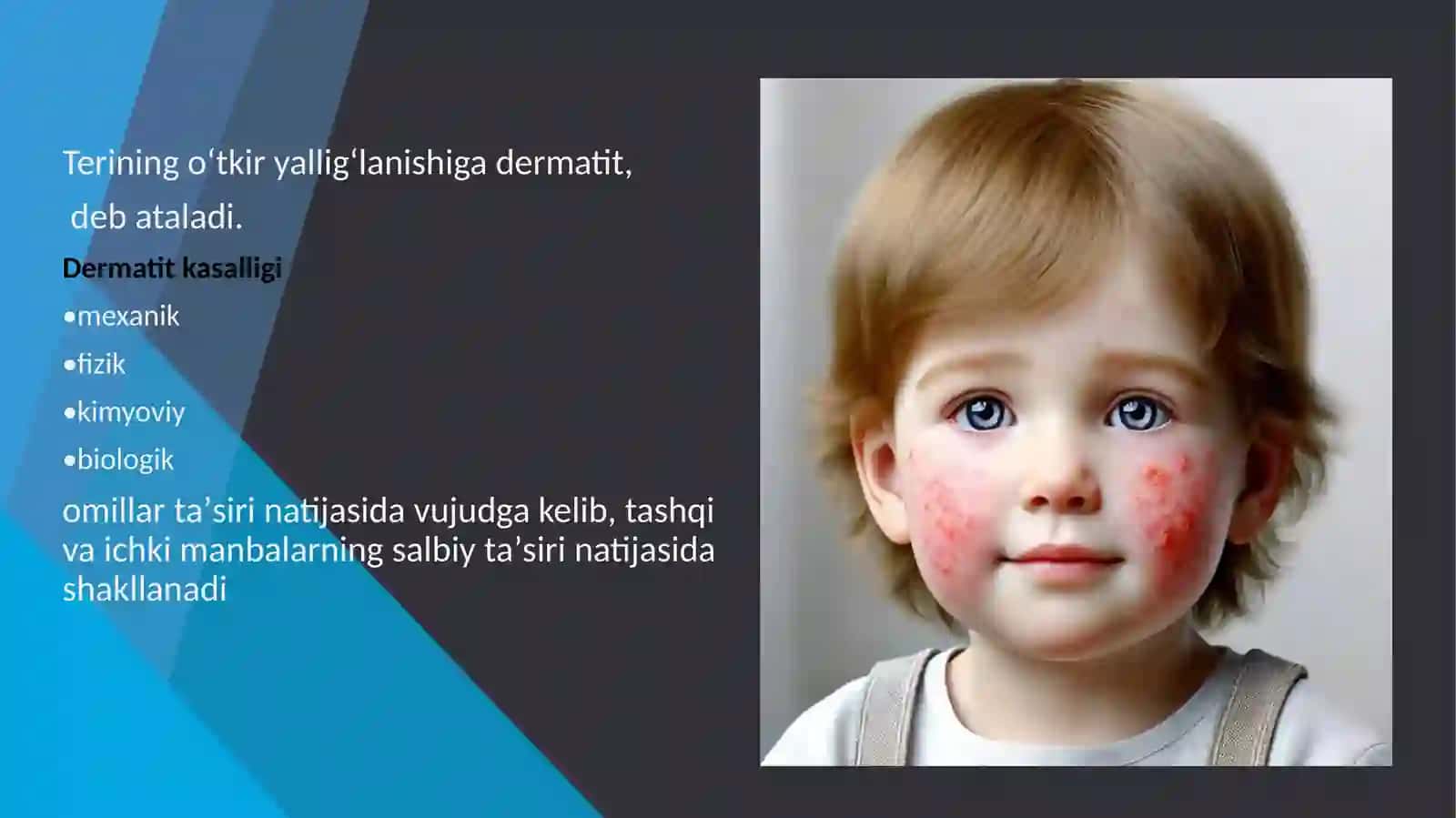 Oddiy va allergik kontakt dermatit. Toksik-allergik dermatit. Ekzema 2