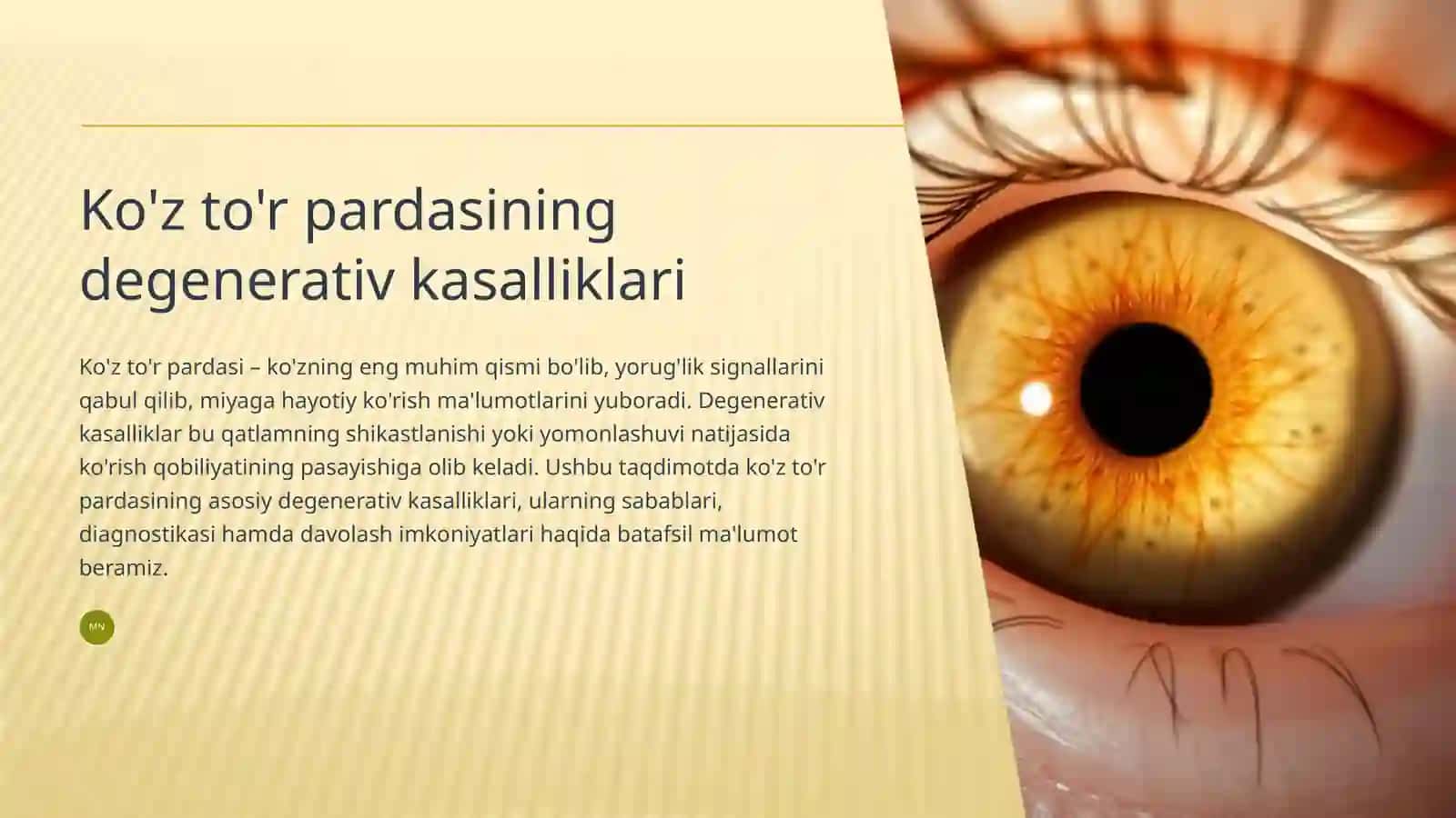 Ko'z to'r pardasining degenerativ kasalliklari 2