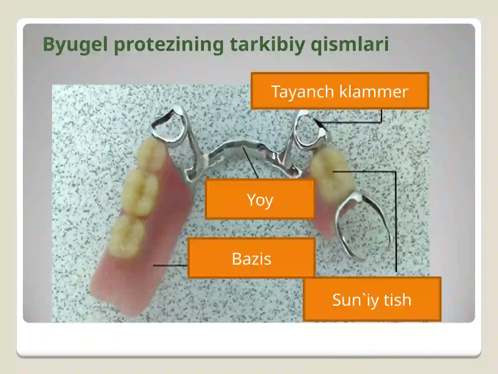 Byugel protezlar bilan protezlashda yuzaga keladigan asoratlar 2