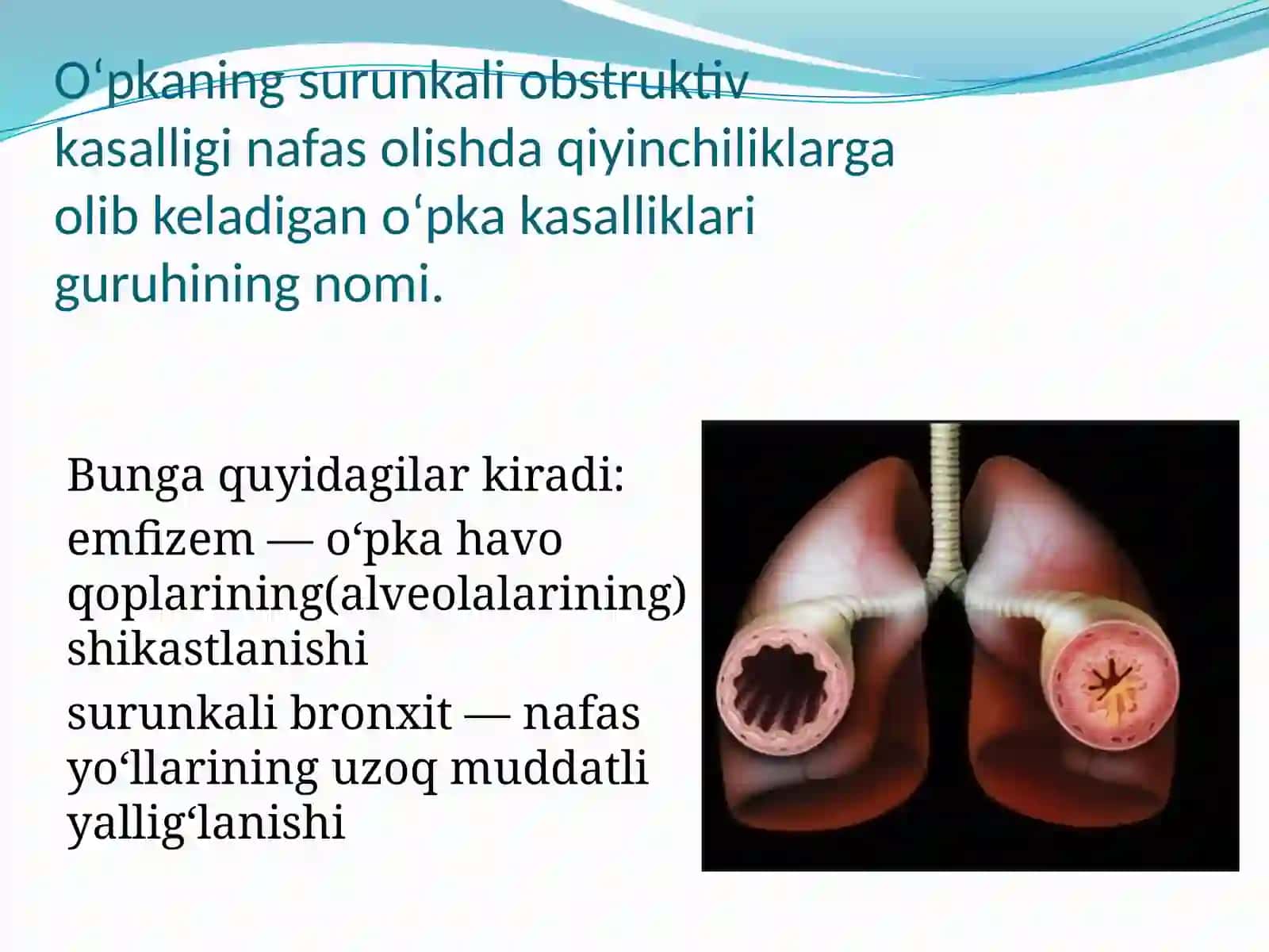 O‘pkaning surunkali obstruktiv kasalligi 2