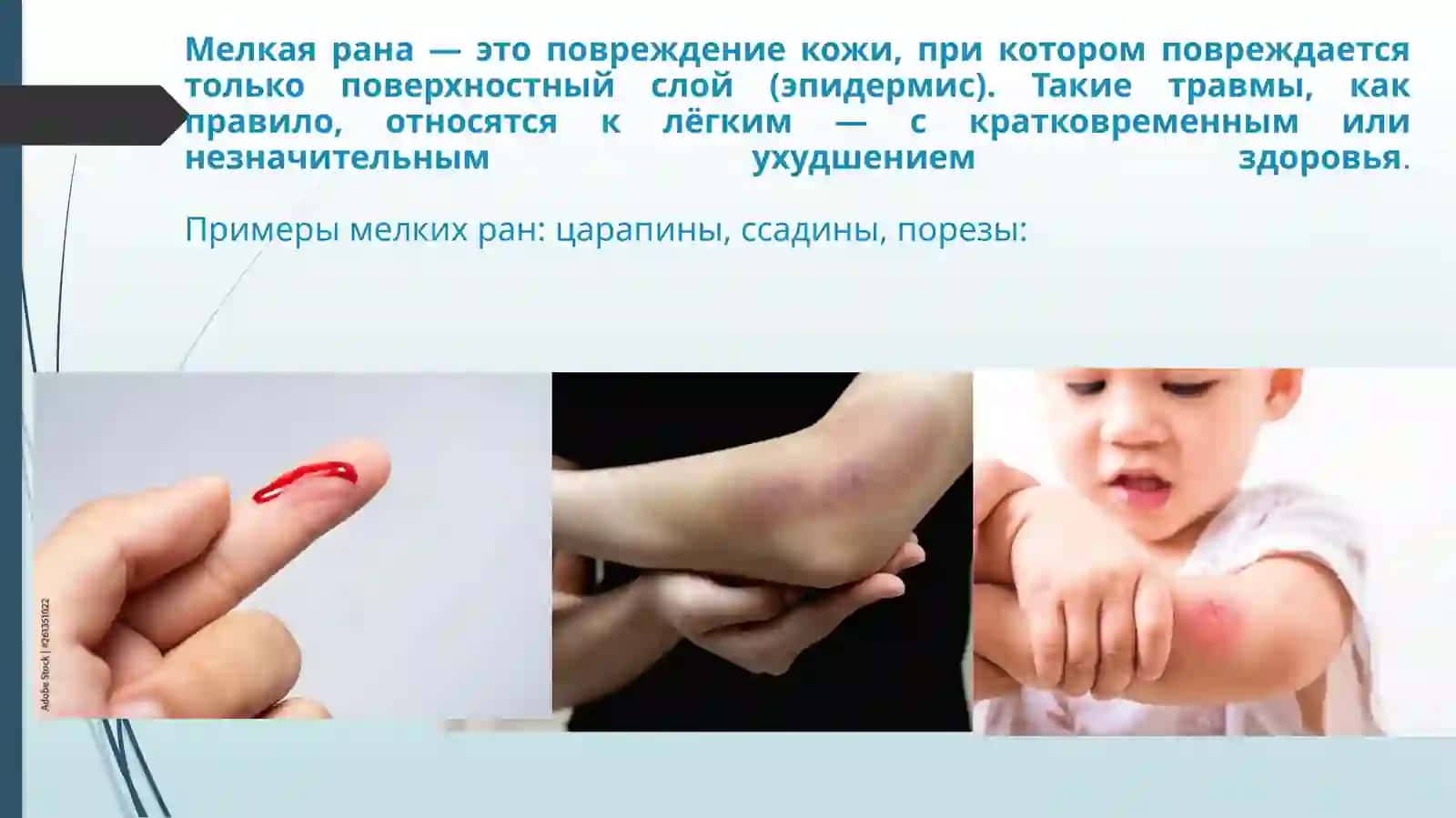 Скорость заживления мелкой раны 2