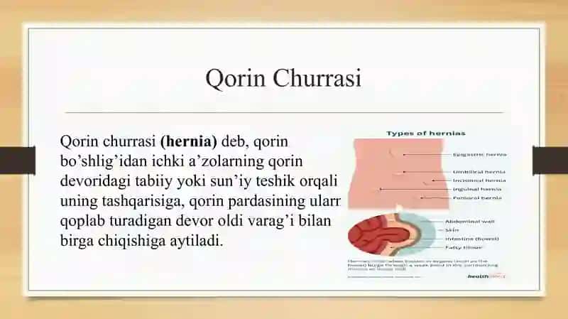 Qorin churrasi Oxta mustaqil ish uchun 2