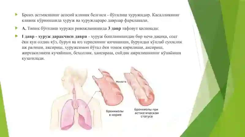 Astmatik Status 2