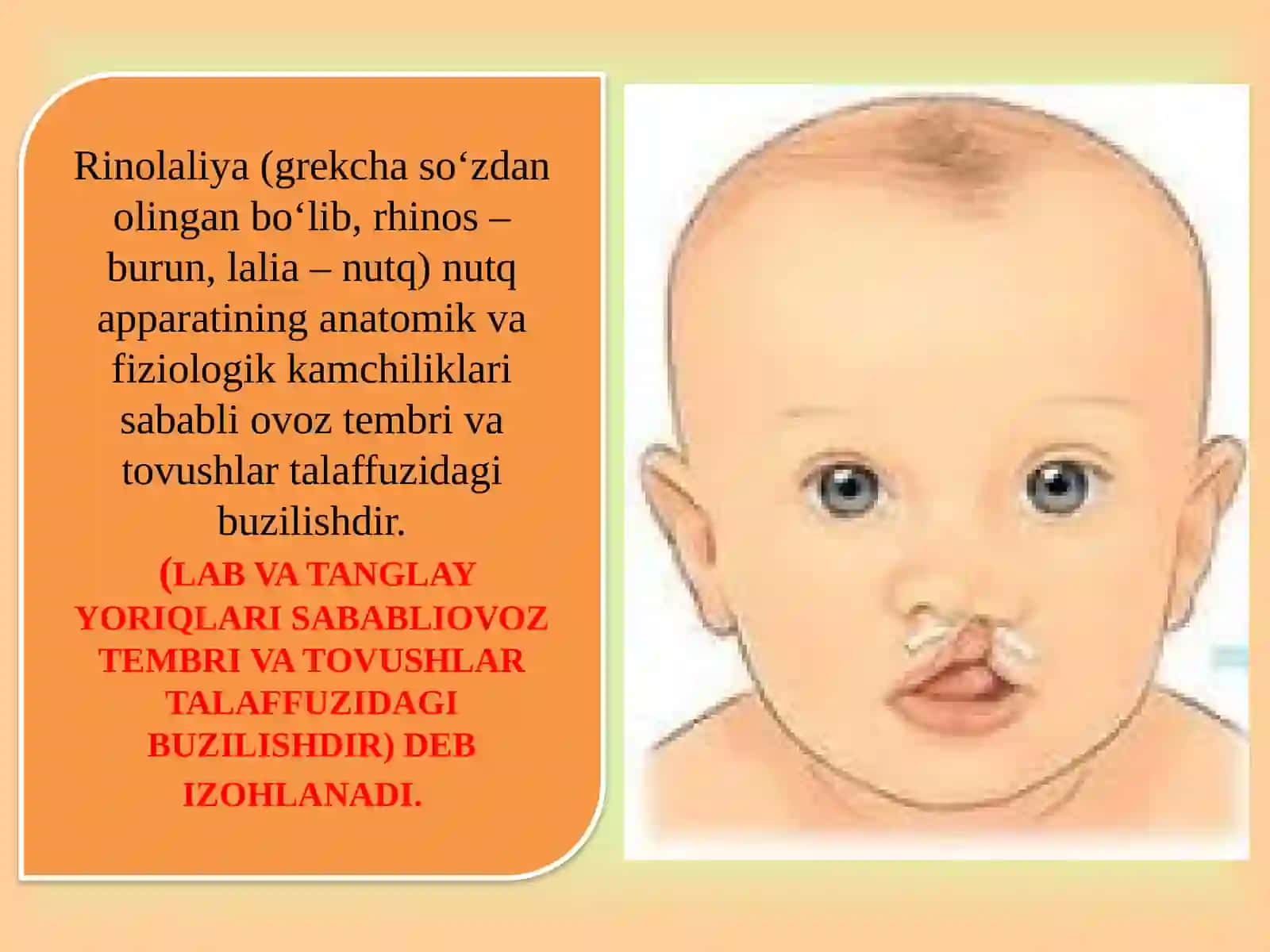 Rinolaliya, uning shakllari, sabablari 2