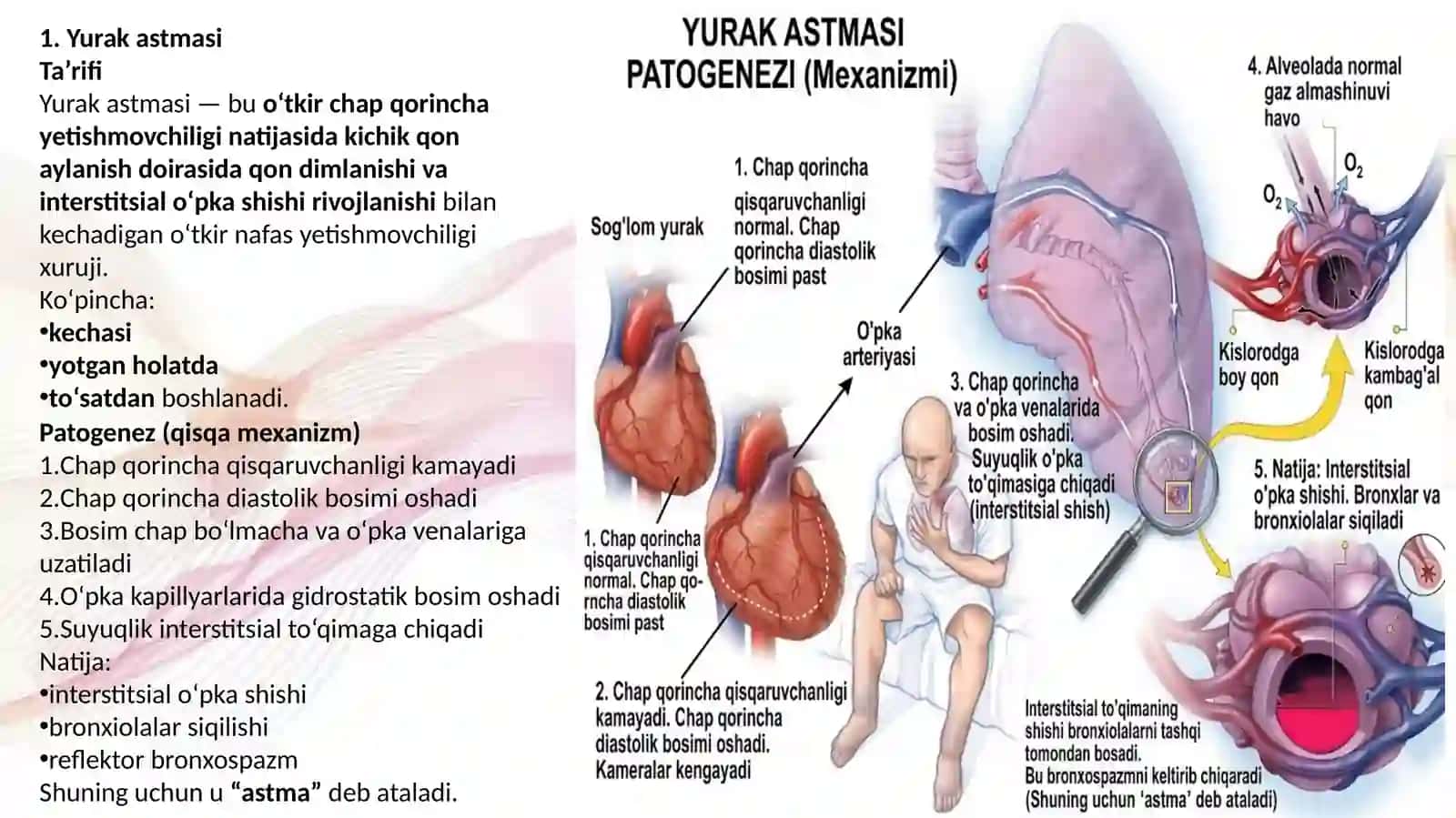 O'pka shishi va yurak astmasi 2
