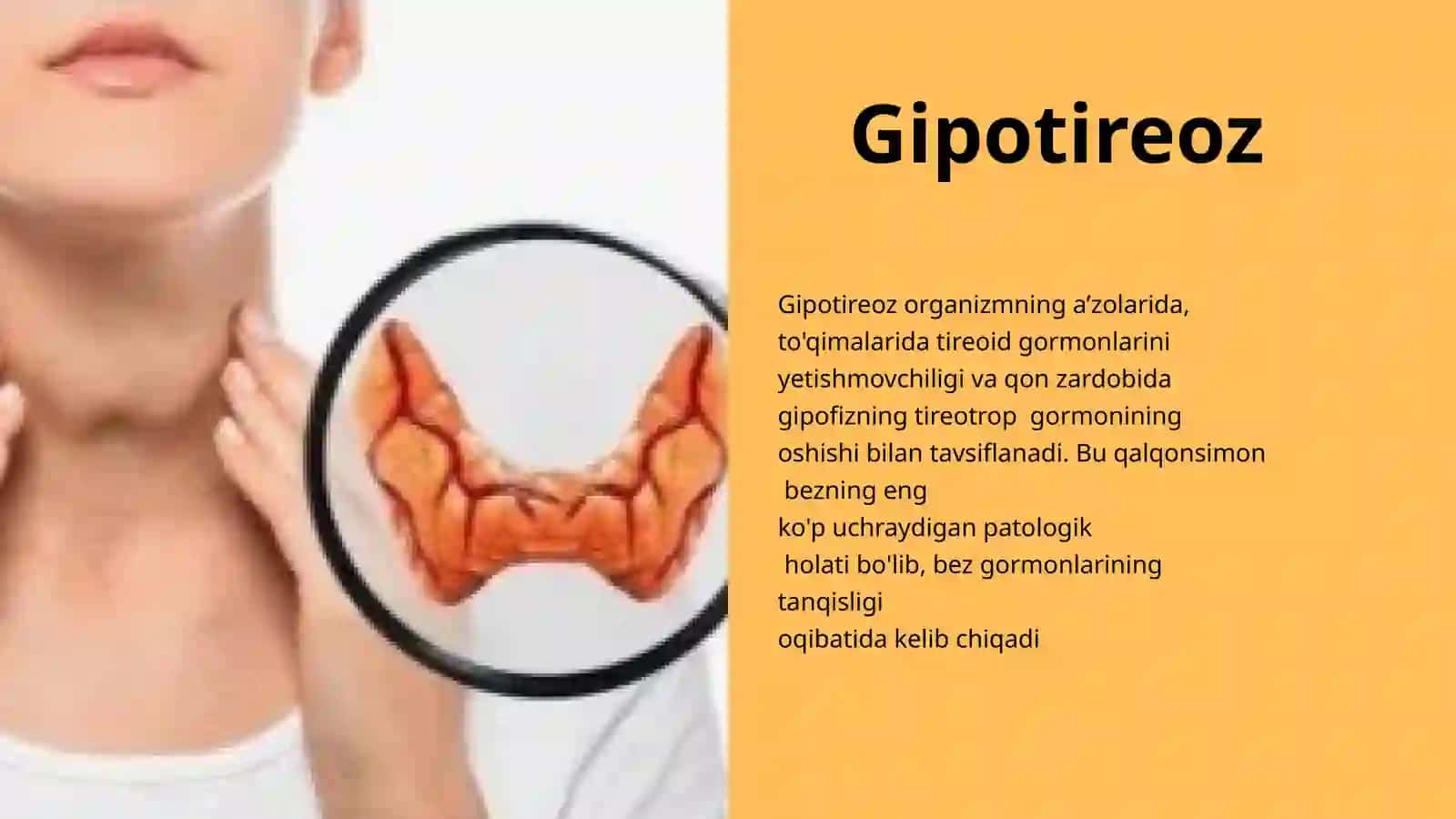Gipotireoz 2