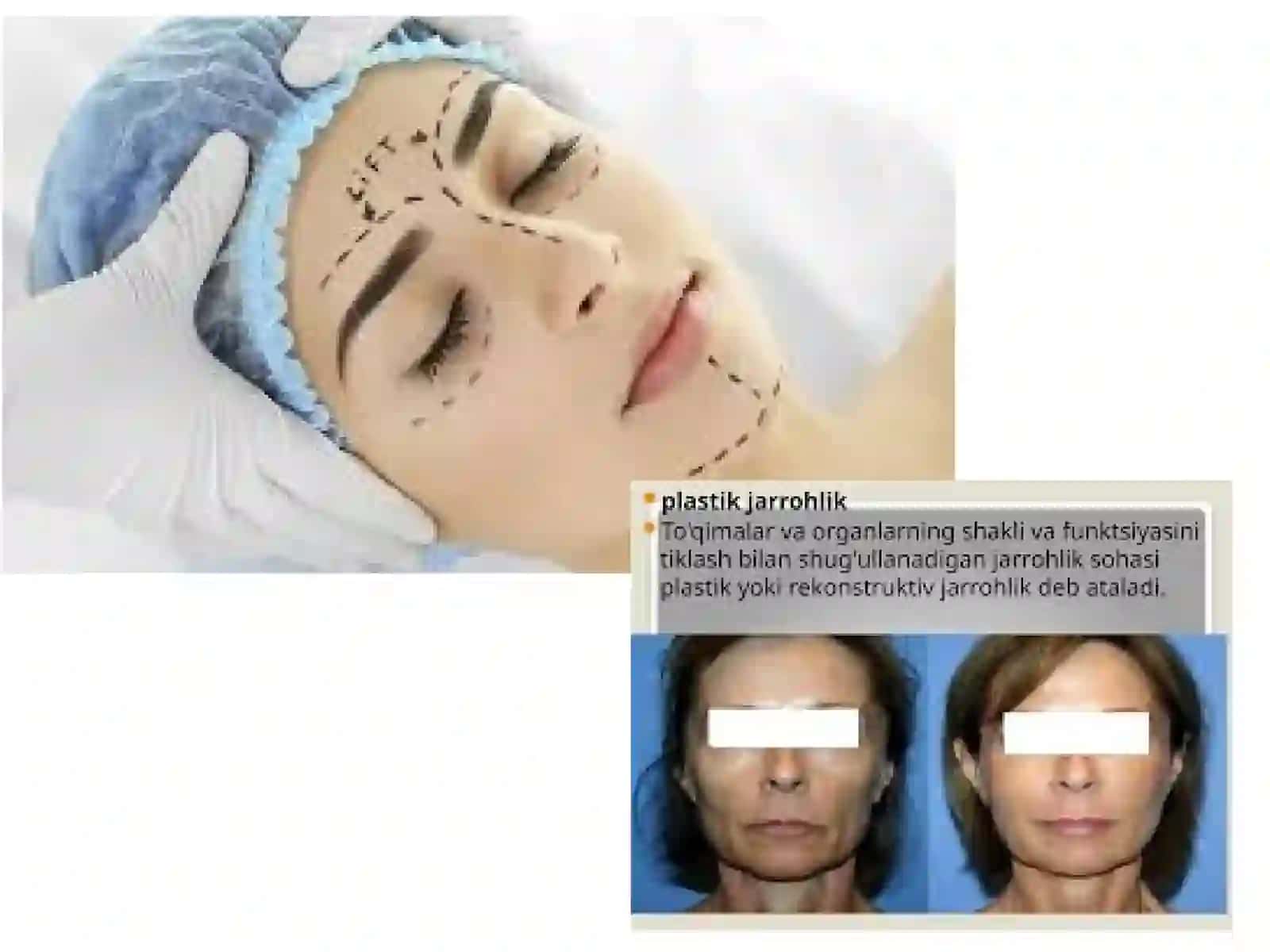 UmumiyxirurgiyaPlastikestetikxirurgikvarekonstruktivxirurgiyaasoslariBajardi 2