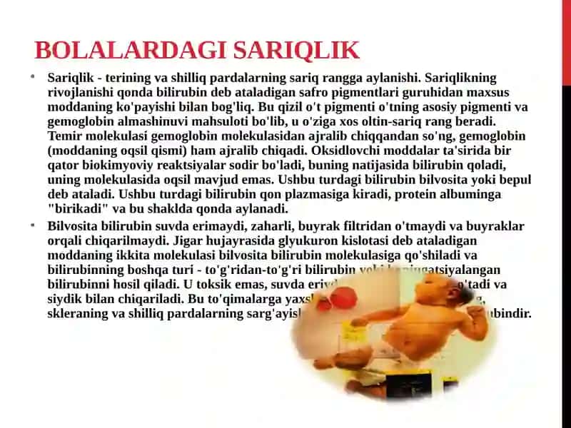 Bolalardagi sariqlik sindromi 2