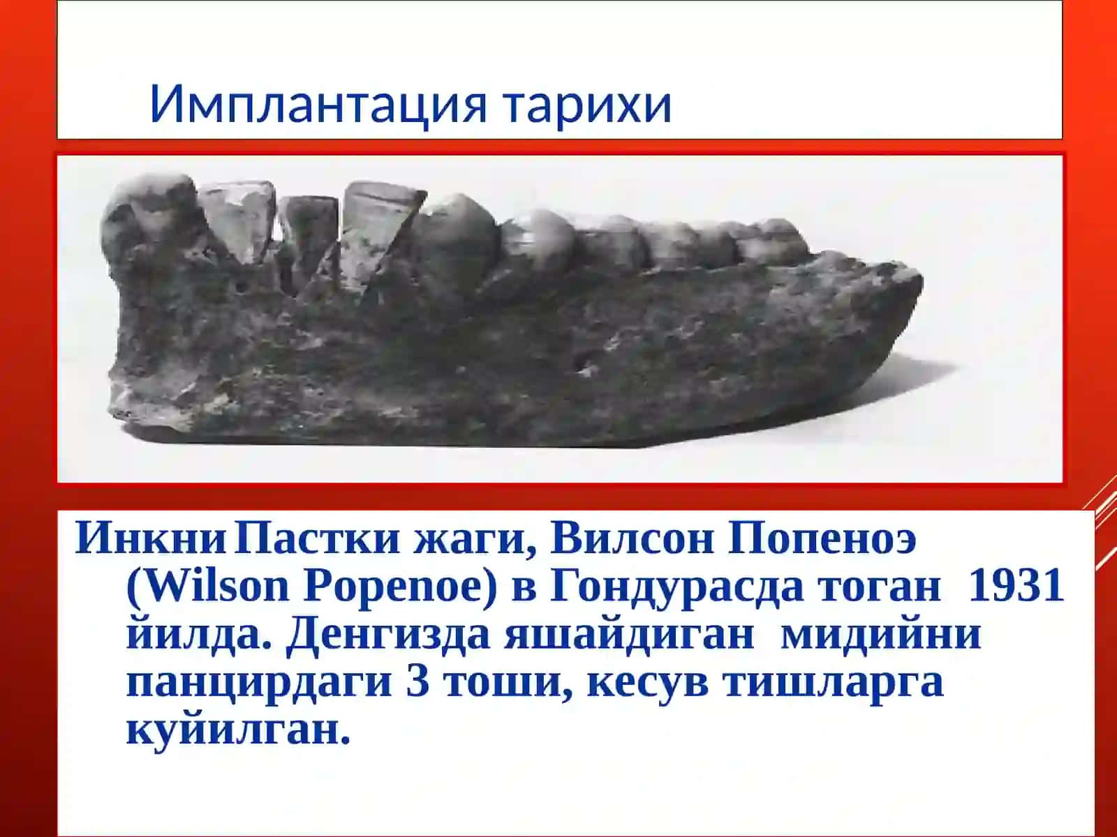 Имплантация тарихи 2