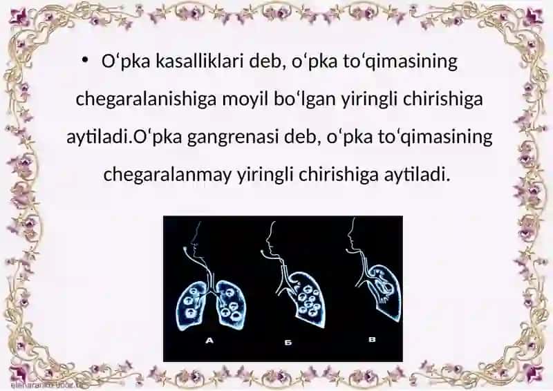 SOMATONEVROLOGIK SINDROMLAR 2
