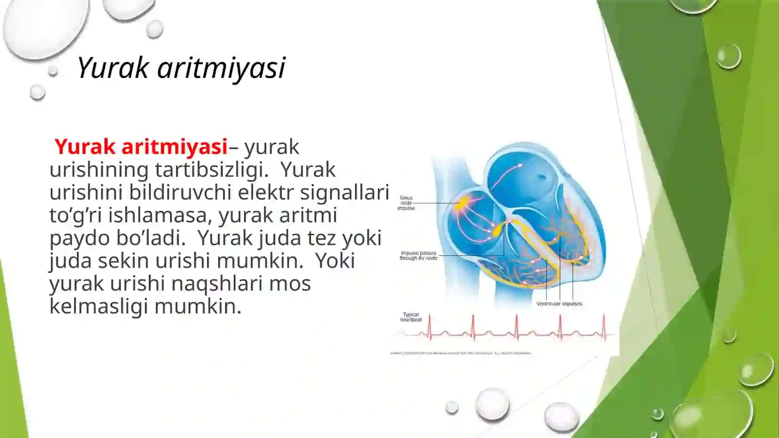 YurakaritmiyalariEKG diagnostikasi 2