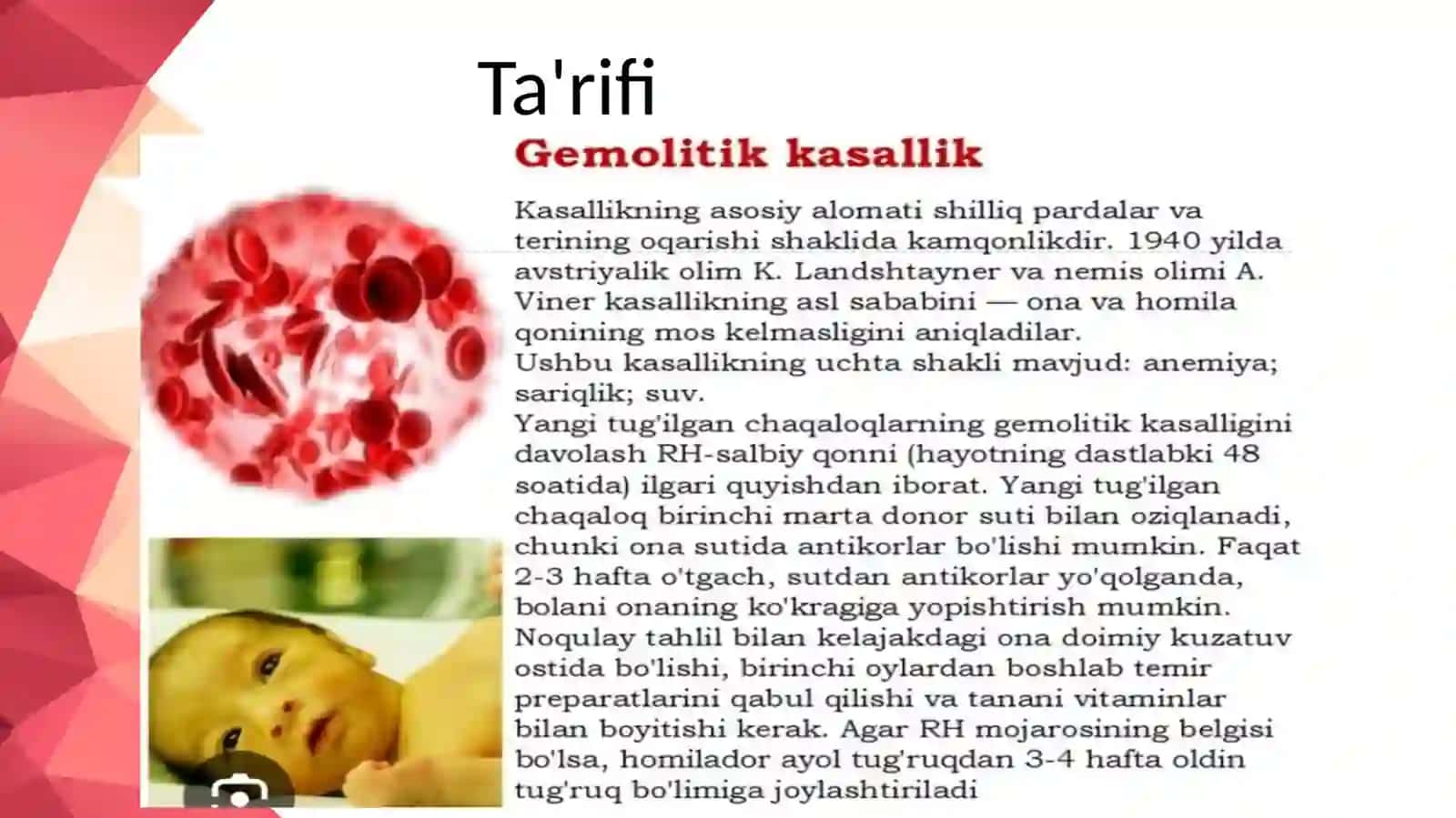 Chaqaloqlar gemolitik kasalligi 2