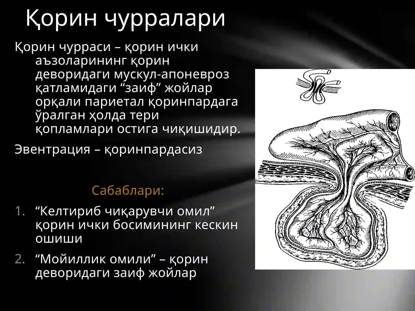Қорин чурралари 2