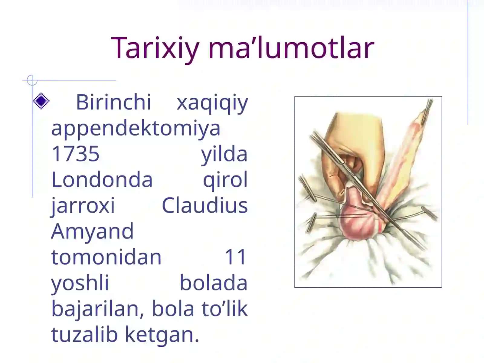 Appendektomiya 2