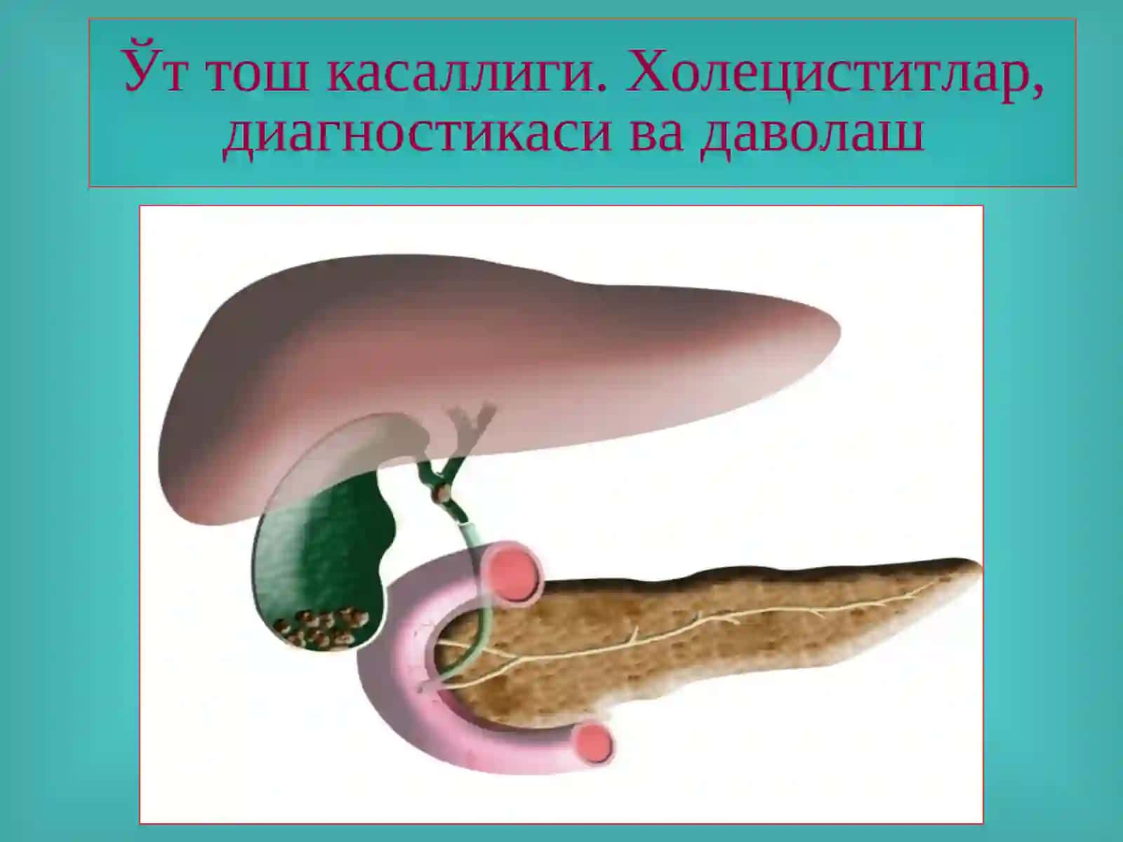 ЎТ-ТОШ КАСАЛЛИГИ. ХОЛЕЦИСТИТЛАР, ДИАГНОСТИКАСИ ВА ДАВОЛАШ 2