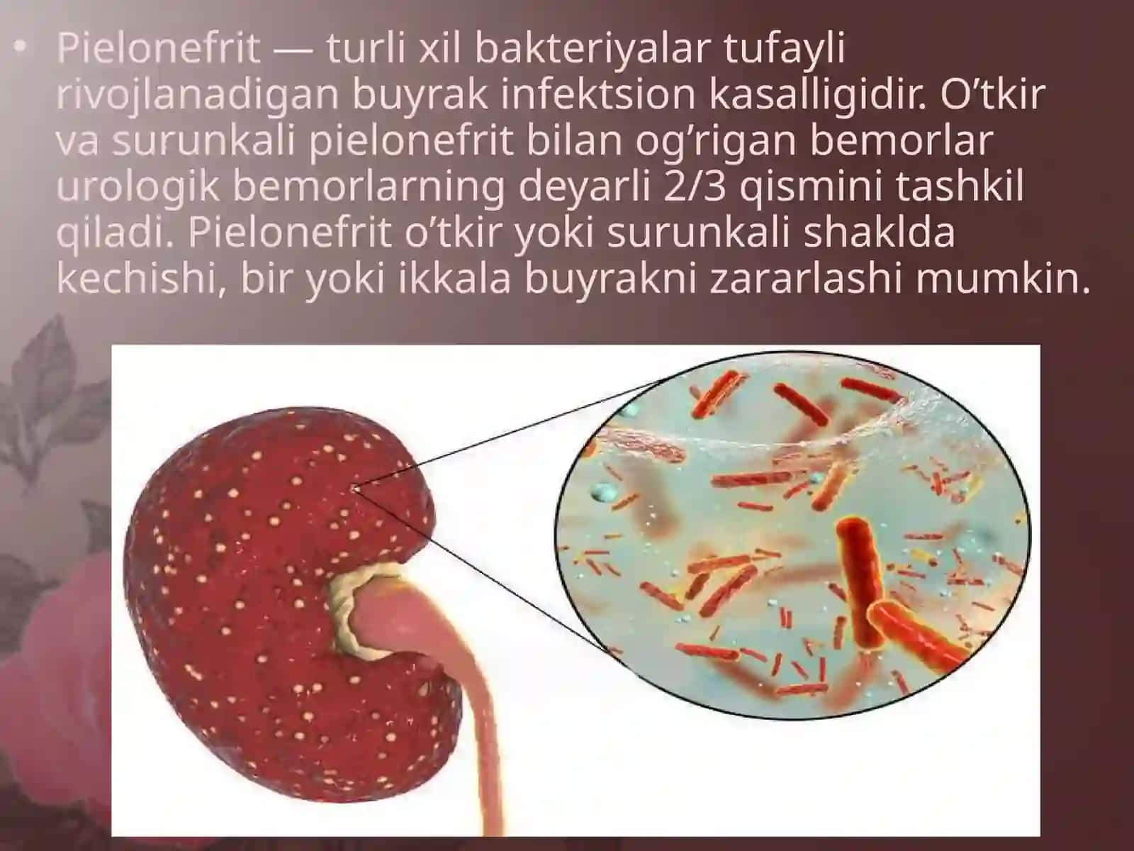O`tkir va surunkali pielonefrit 2