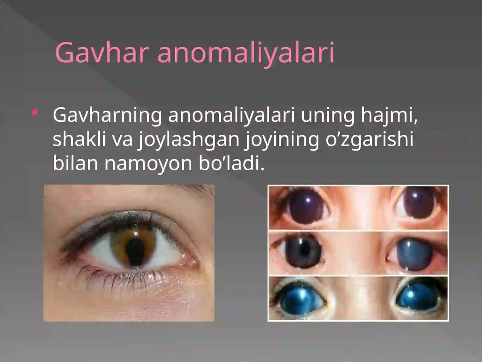 GAVHAR ANOMALIYALARI 2