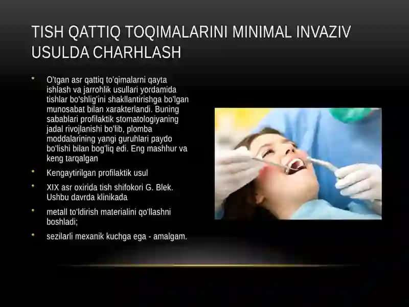 Tish qattiq toqimalarining minimal invaziv usulda charxlash 2