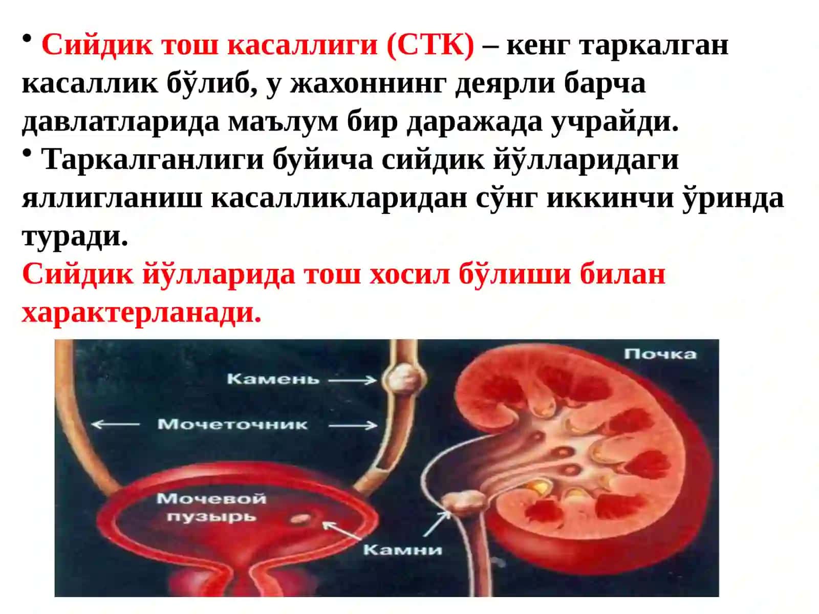 СИЙДИК ТОШ КАСАЛЛИГИ 2