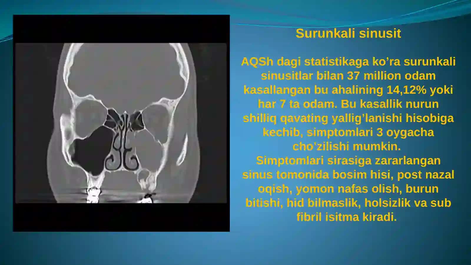 Yuqori jag’ bo’shlig’ini punksiyasi 2