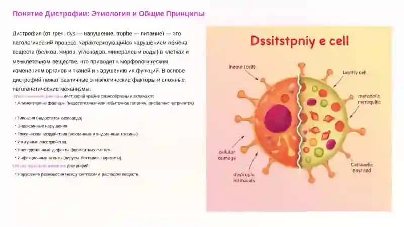 Дистрофия. Классификация и механизмы. 2