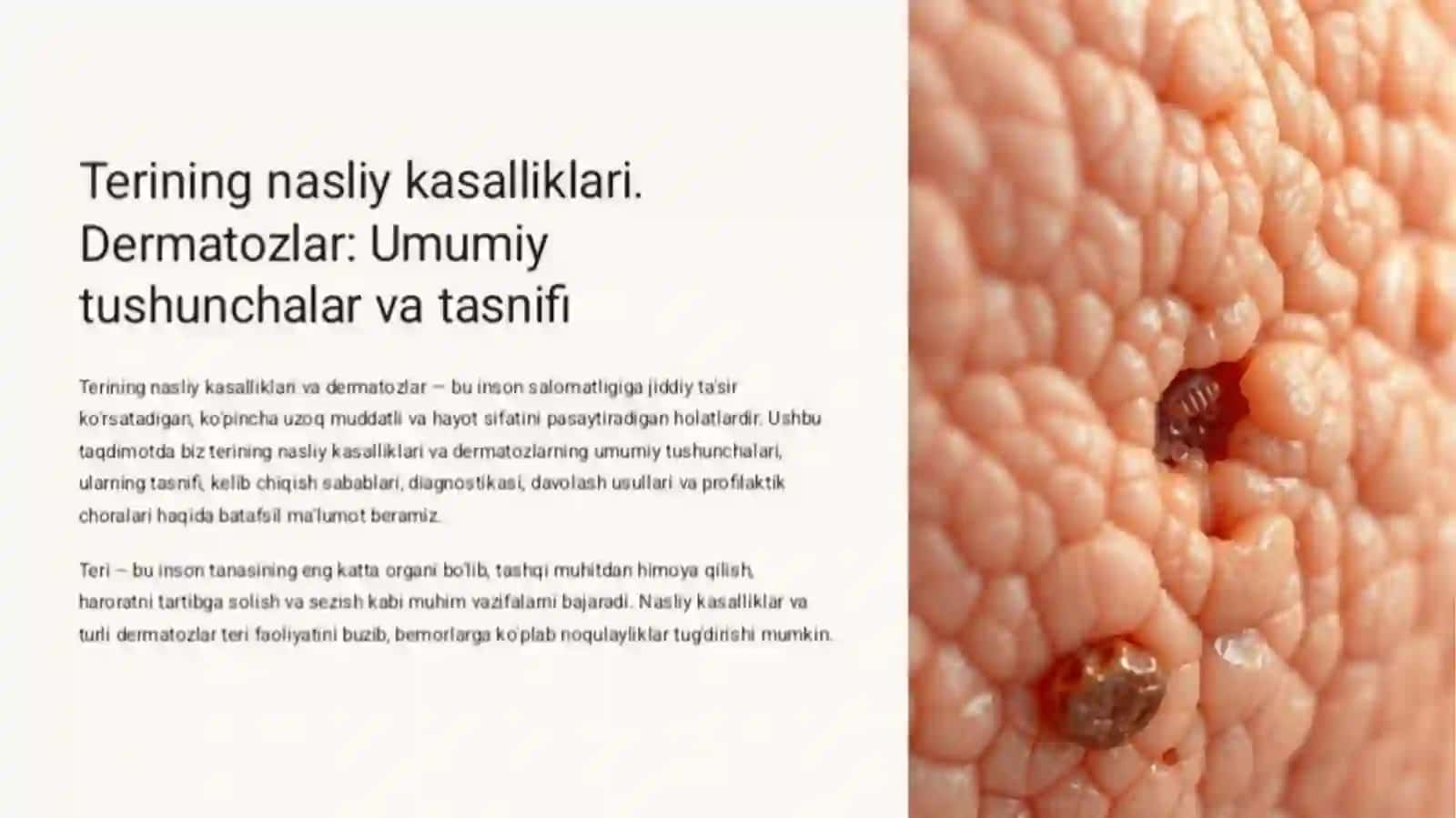 Teri irsiy kasalliklari 2