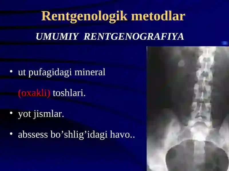 GEPATOBILIAR TIZIMI KASALLIKLARINI NUR DIAGNOSTIKASI 2