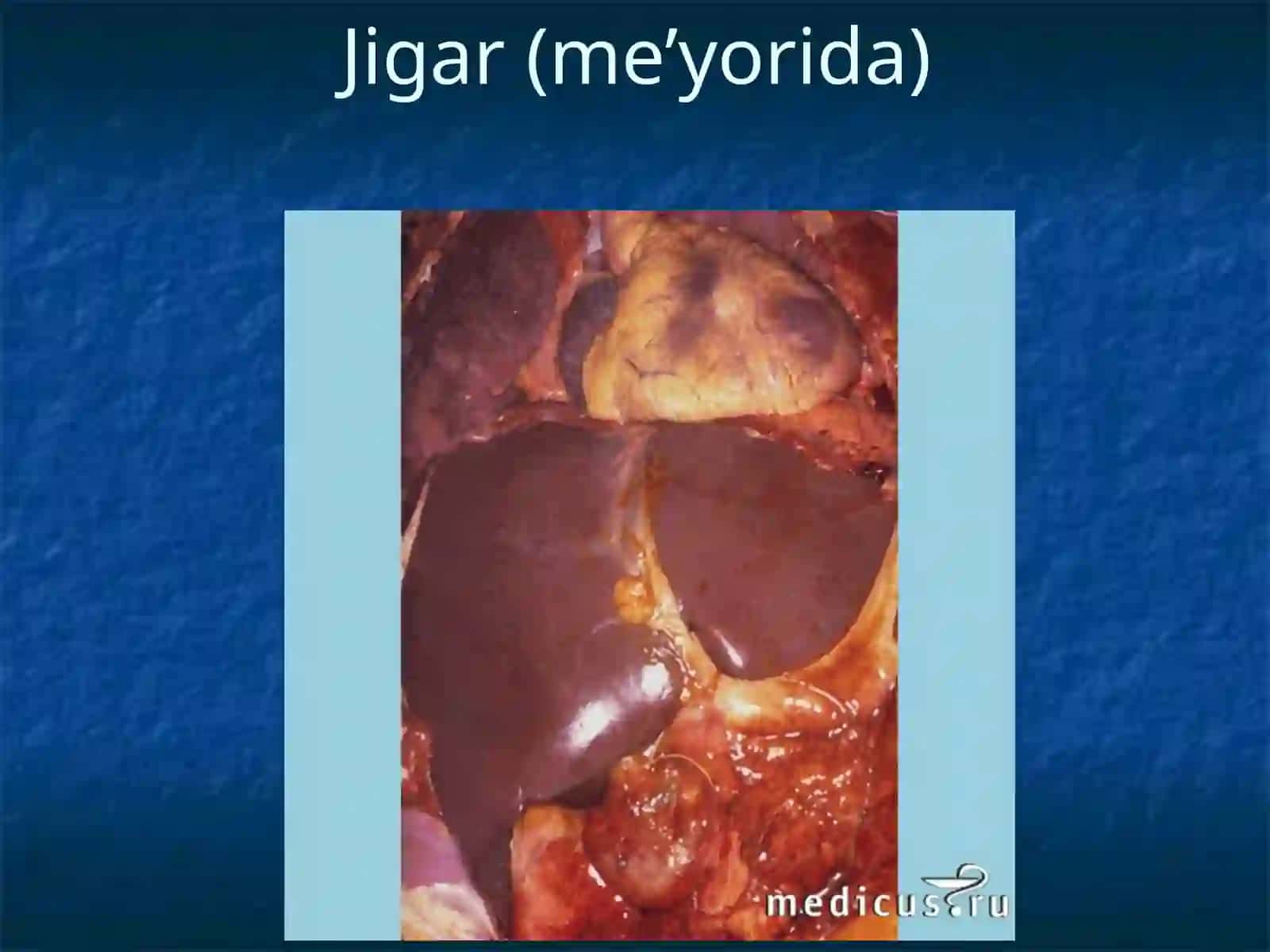JIGAR SIRROZI 2