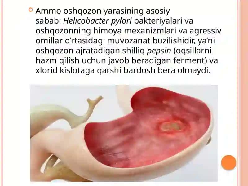 Oshqozon shirasi 2