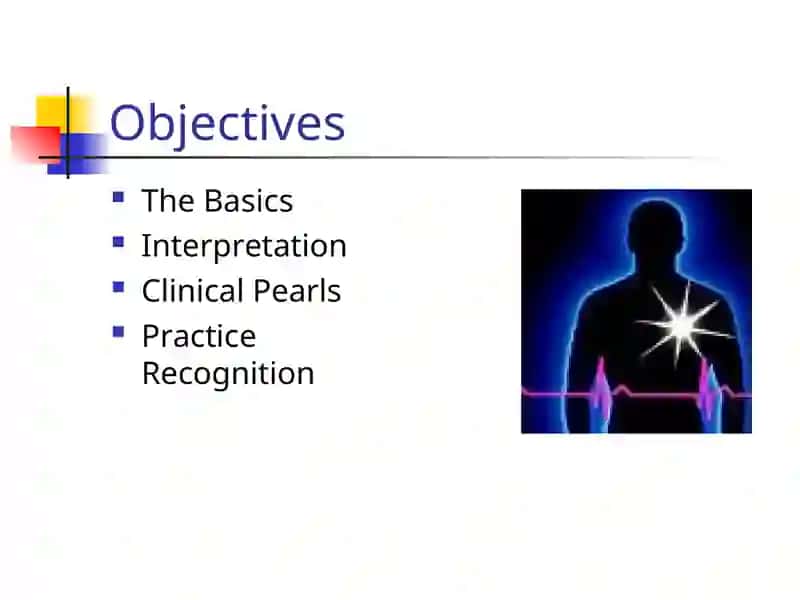 EKG Interpretation 2