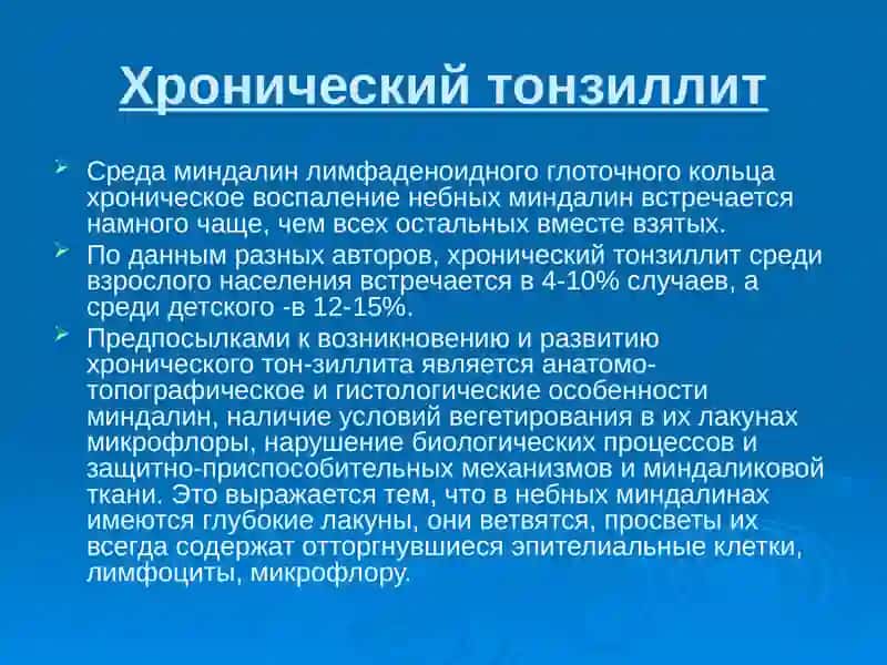 Хронический тонзиллит 2