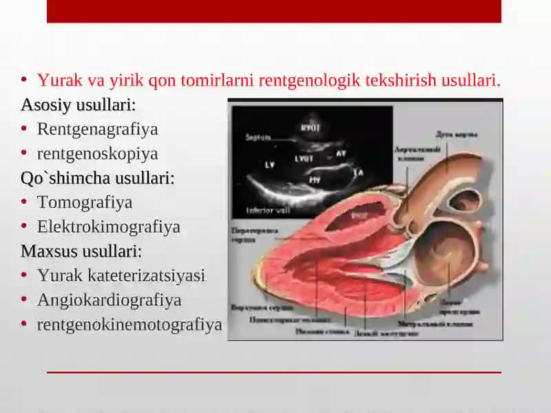 Nur diagnostikasi vaterapiyasi 2