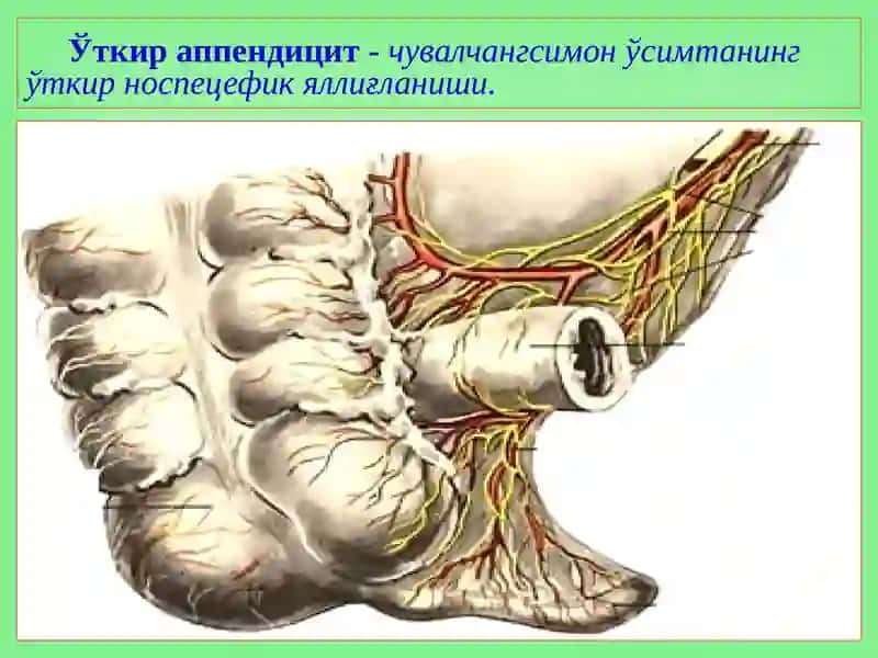 O’tkir appendetsit asoratlari 2