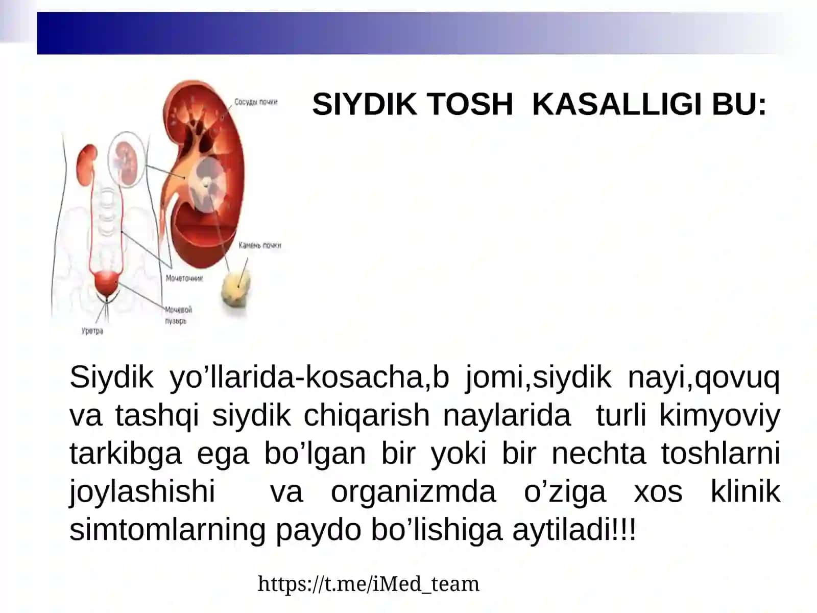 SIYDIK TOSH KASALLIGI 2